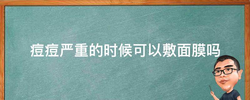 痘痘严重的时候可以敷面膜吗 痘痘很严重可以敷面膜吗