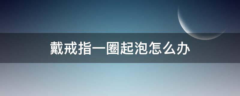 戴戒指一圈起泡怎么办 戴戒指一圈起泡怎么办小妙招